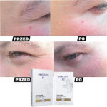 PŁATKI POD OCZY MERCILEN KOLEGAEN 3 STOPNIA SILNIE WYGŁADZAJĄCE ZMARSZCZKI noc dzień rutyna edamaris prezent dojrzała cera starość przed po efekt